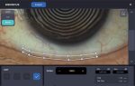 ⁦HTG-1⁩ – תמונה ⁦2⁩